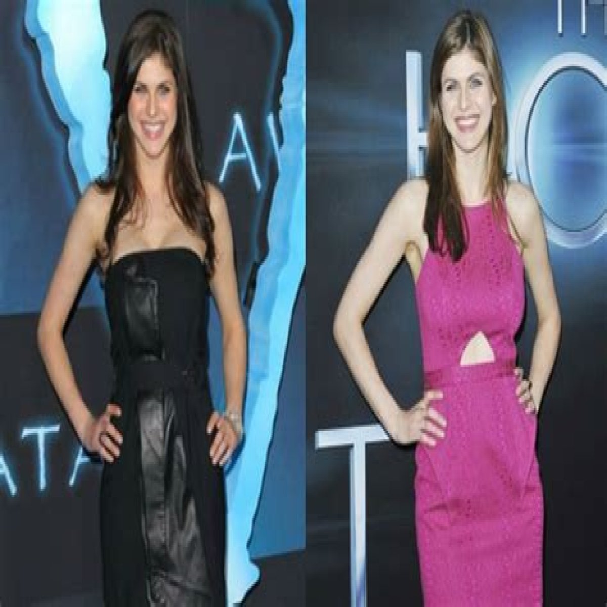 Alexandra Daddario Plastic Surgery Before and After