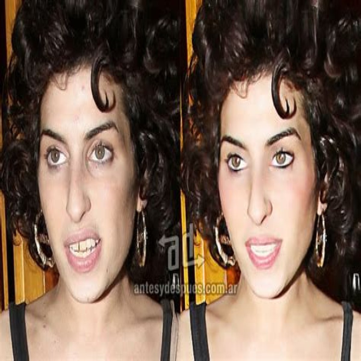 Amy Winehouse’s friends say she wants butt implants