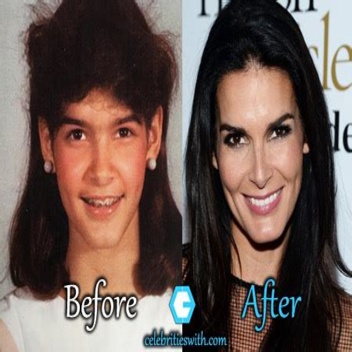Angie Harmon Plastic Surgery Before and After