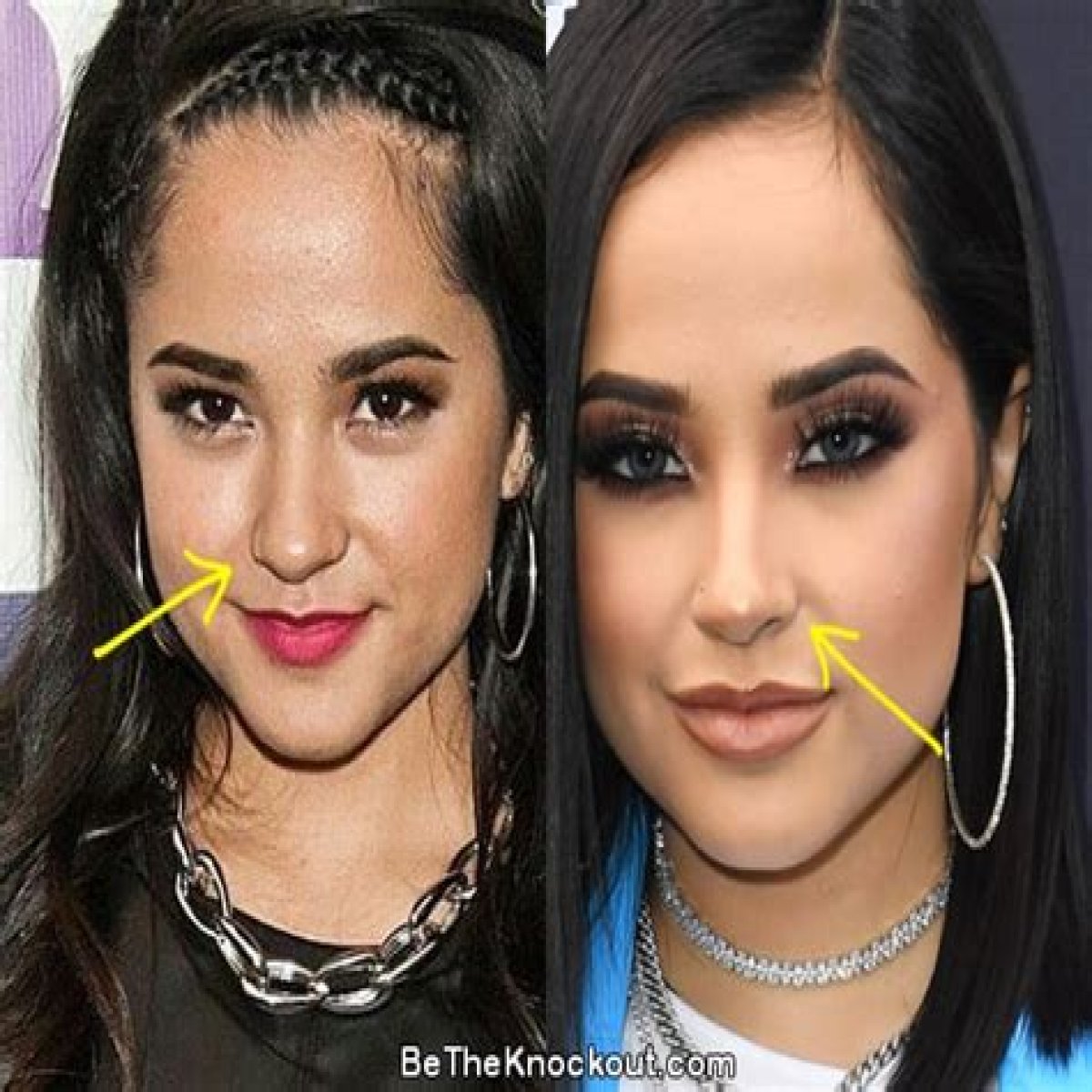 Becky G Plastic Surgery Before and After