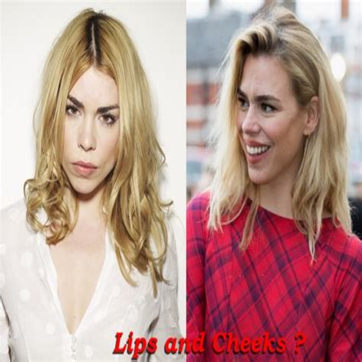 Billie Piper Plastic Surgery Before and After