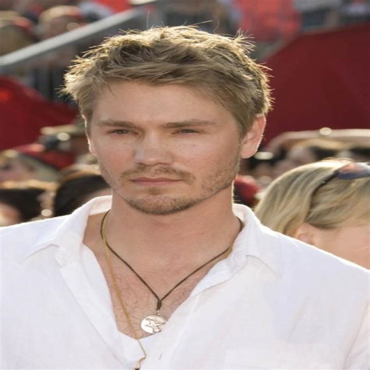 Chad Michael Murray Plastic Surgery Before and After