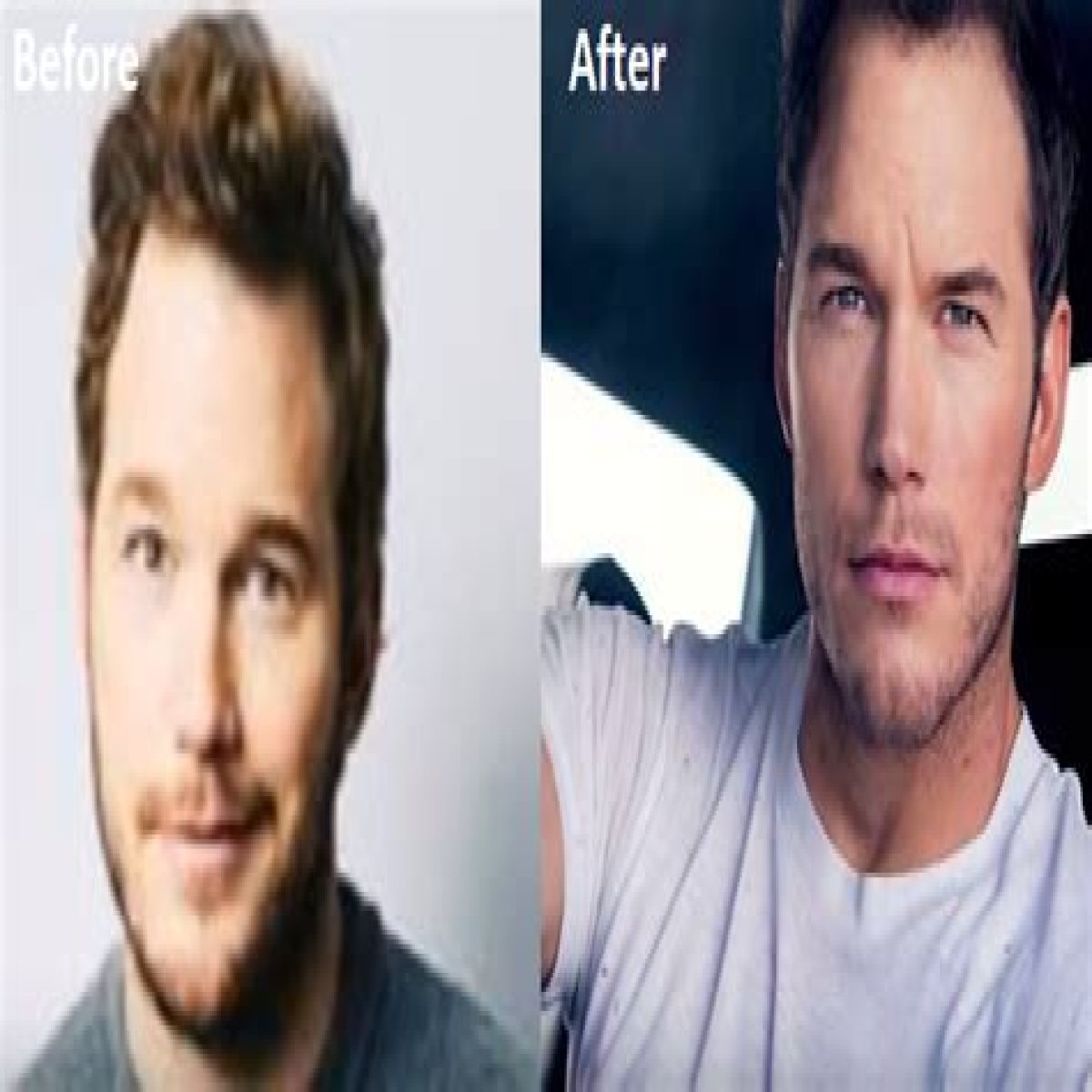 Chris Pratt Plastic Surgery Before and After