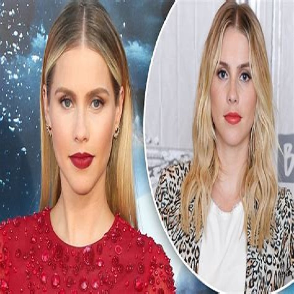 Claire Holt Plastic Surgery Before and After