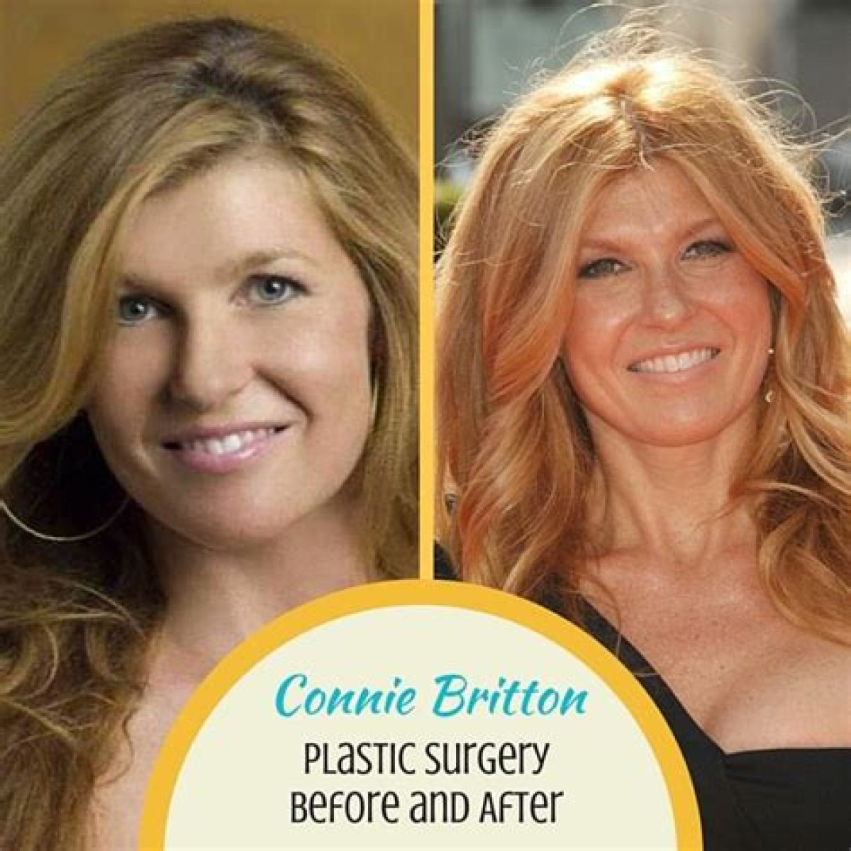 Connie Britton Plastic Surgery Before and After