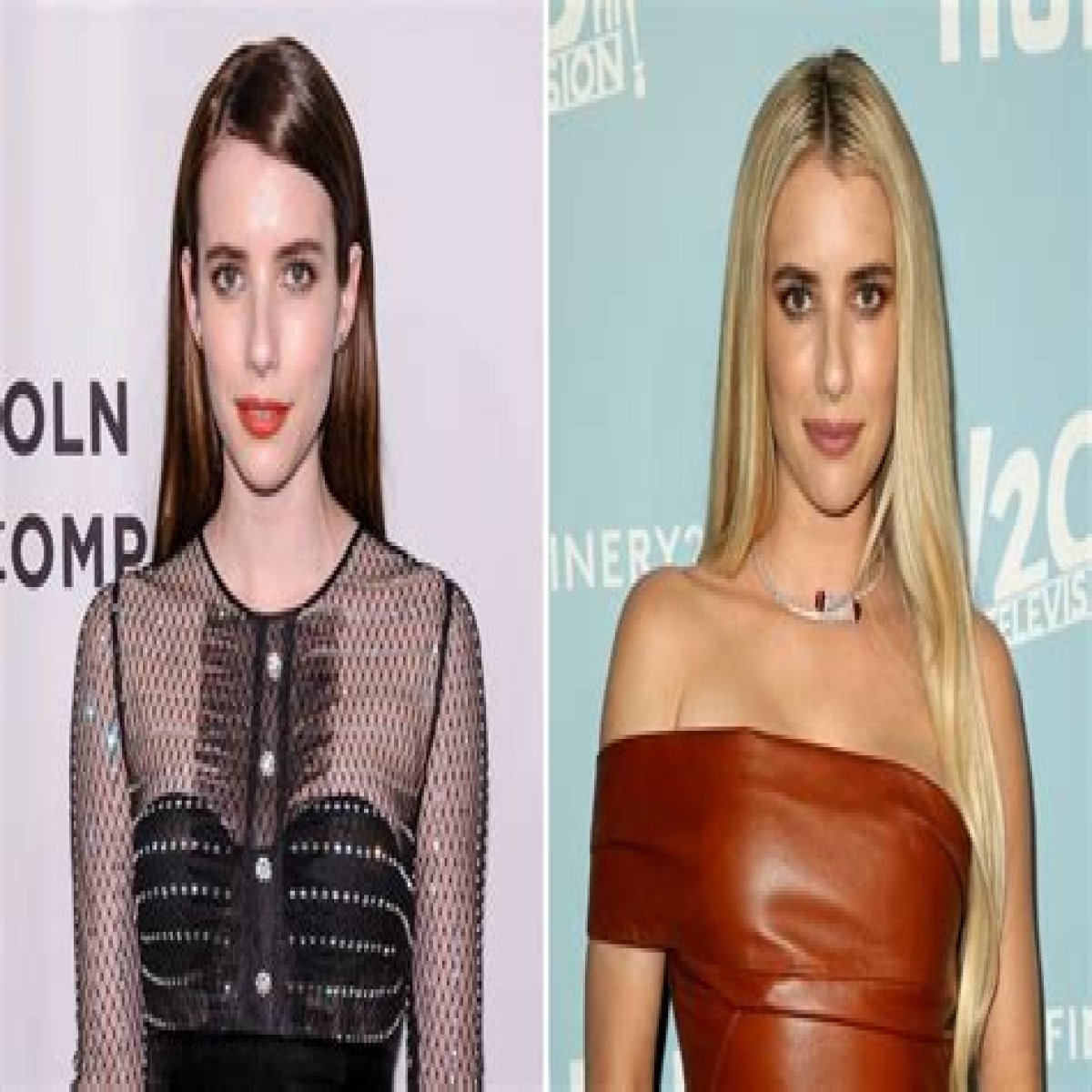 Emma Roberts Plastic Surgery Before and After