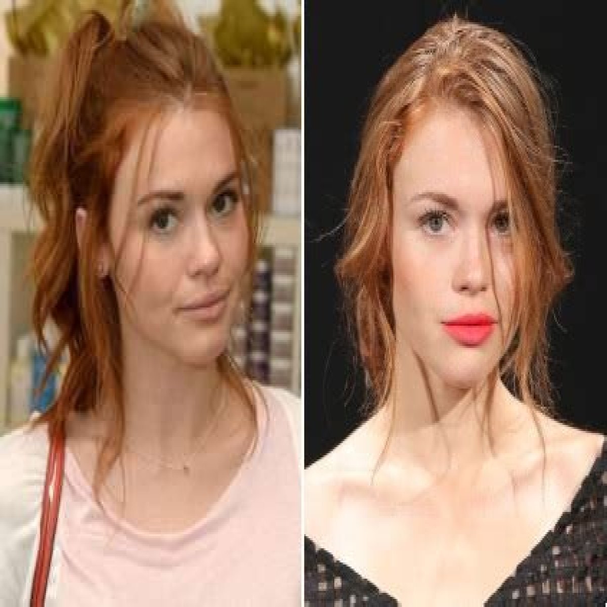 Holland Roden Plastic Surgery Before and After