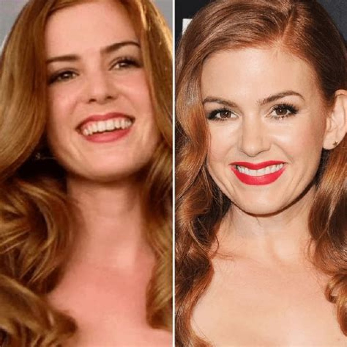 Isla Fisher Plastic Surgery Before and After