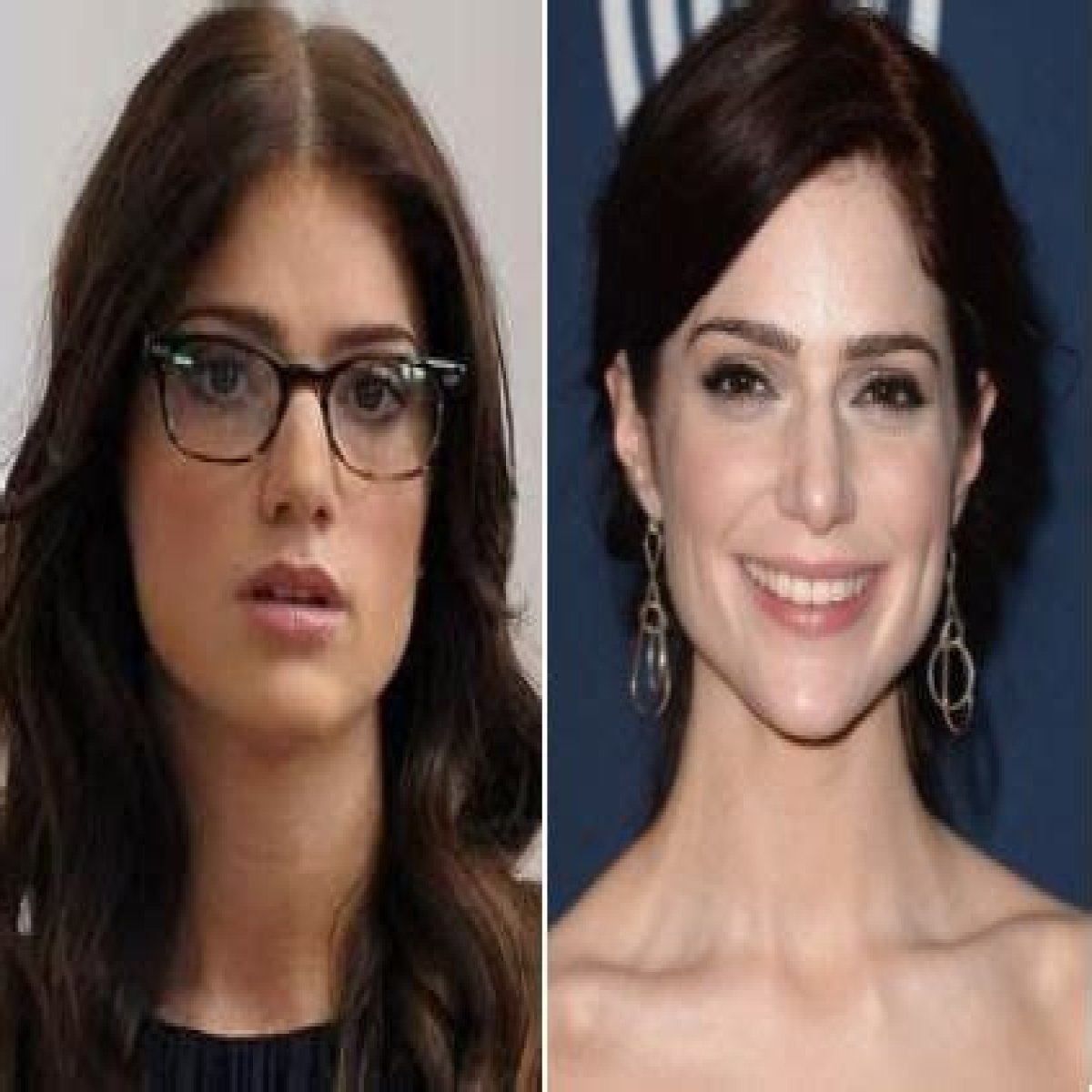 Janet Montgomery Plastic Surgery Before and After