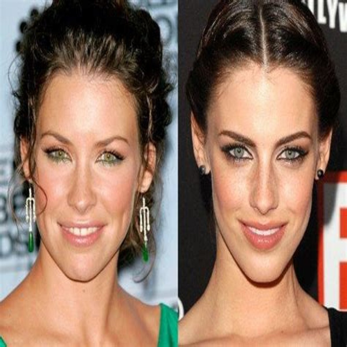 Jessica Lowndes Plastic Surgery Before and After