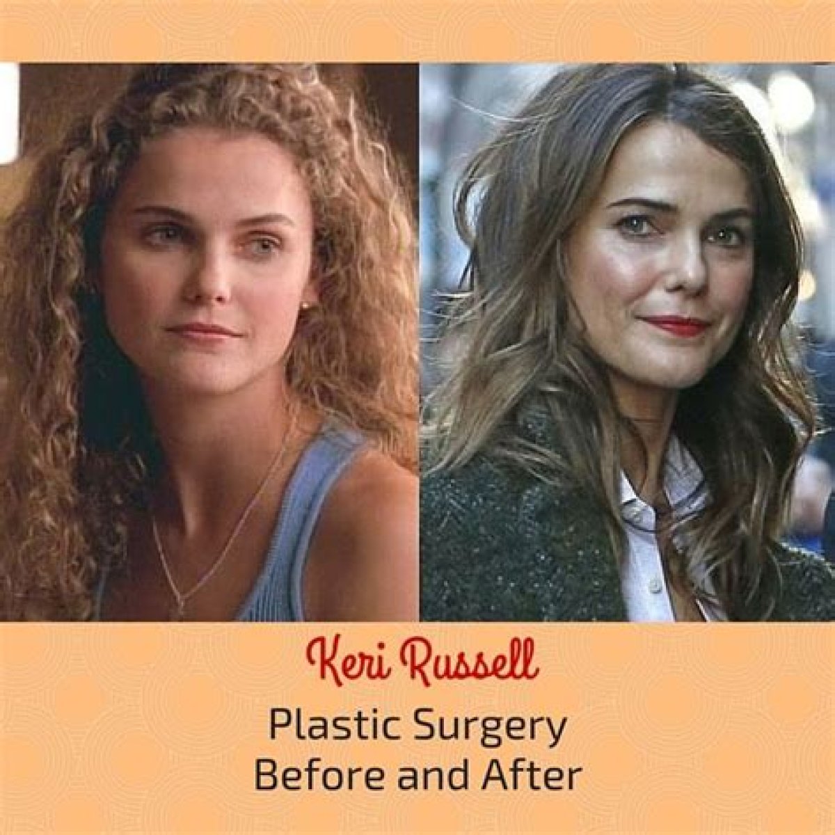 Keri Russell Plastic Surgery Before and After