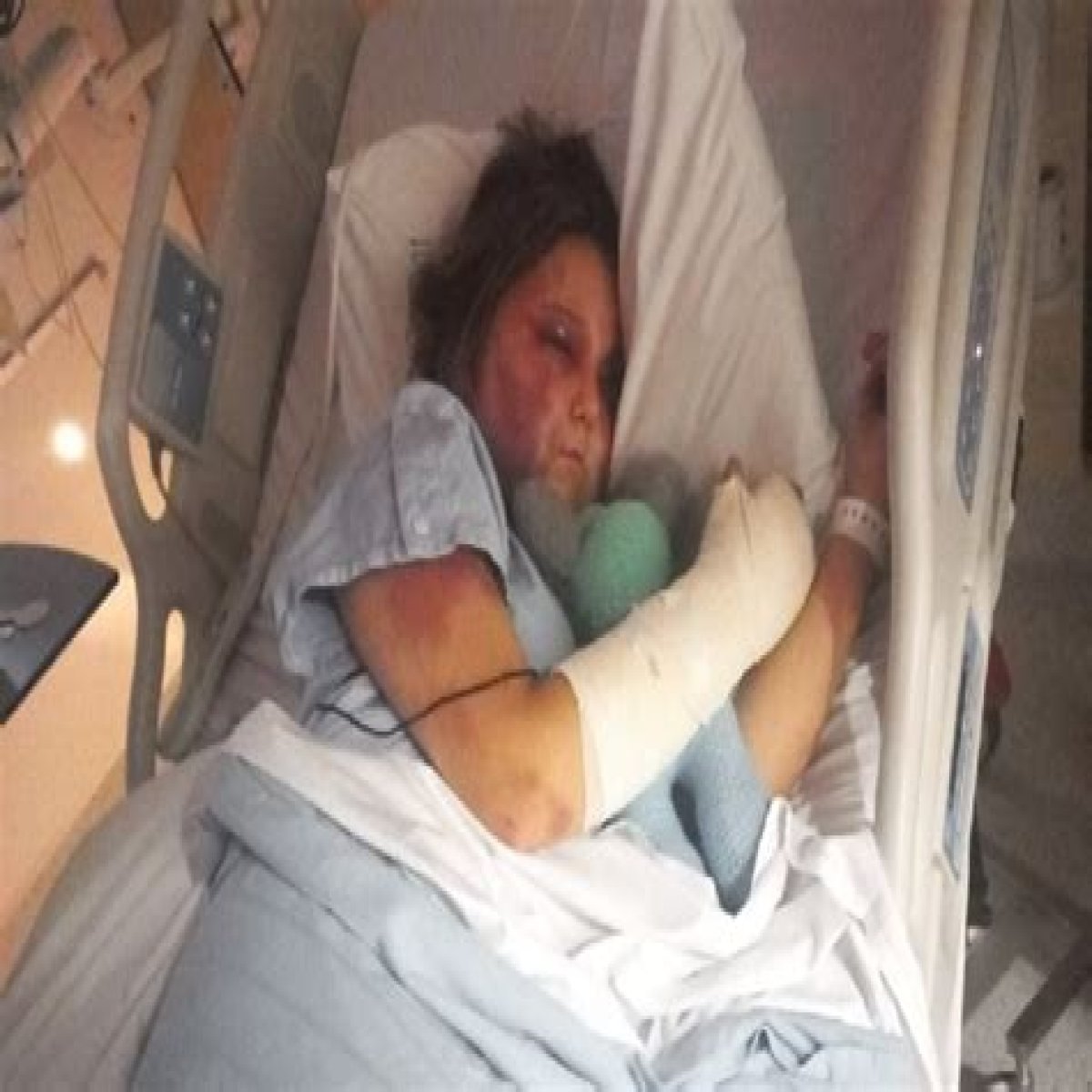 Kirra Hart Attack Video Tewantin Girl Bashed Bashed, Girl Tortured After Being Lured To Sunshine Coast Home