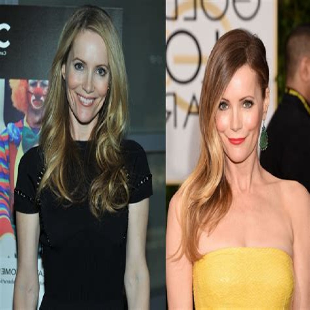 Leslie Mann Plastic Surgery Before and After