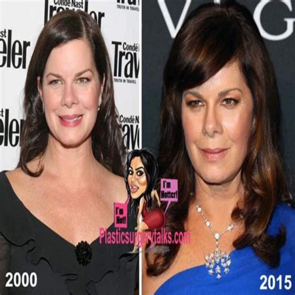 Marcia Gay Harden Plastic Surgery Before and After