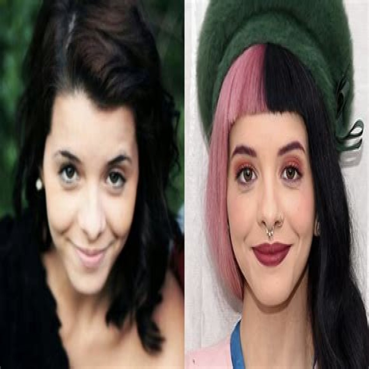 Melanie Martinez's Plastic Surgery Journey Revealed