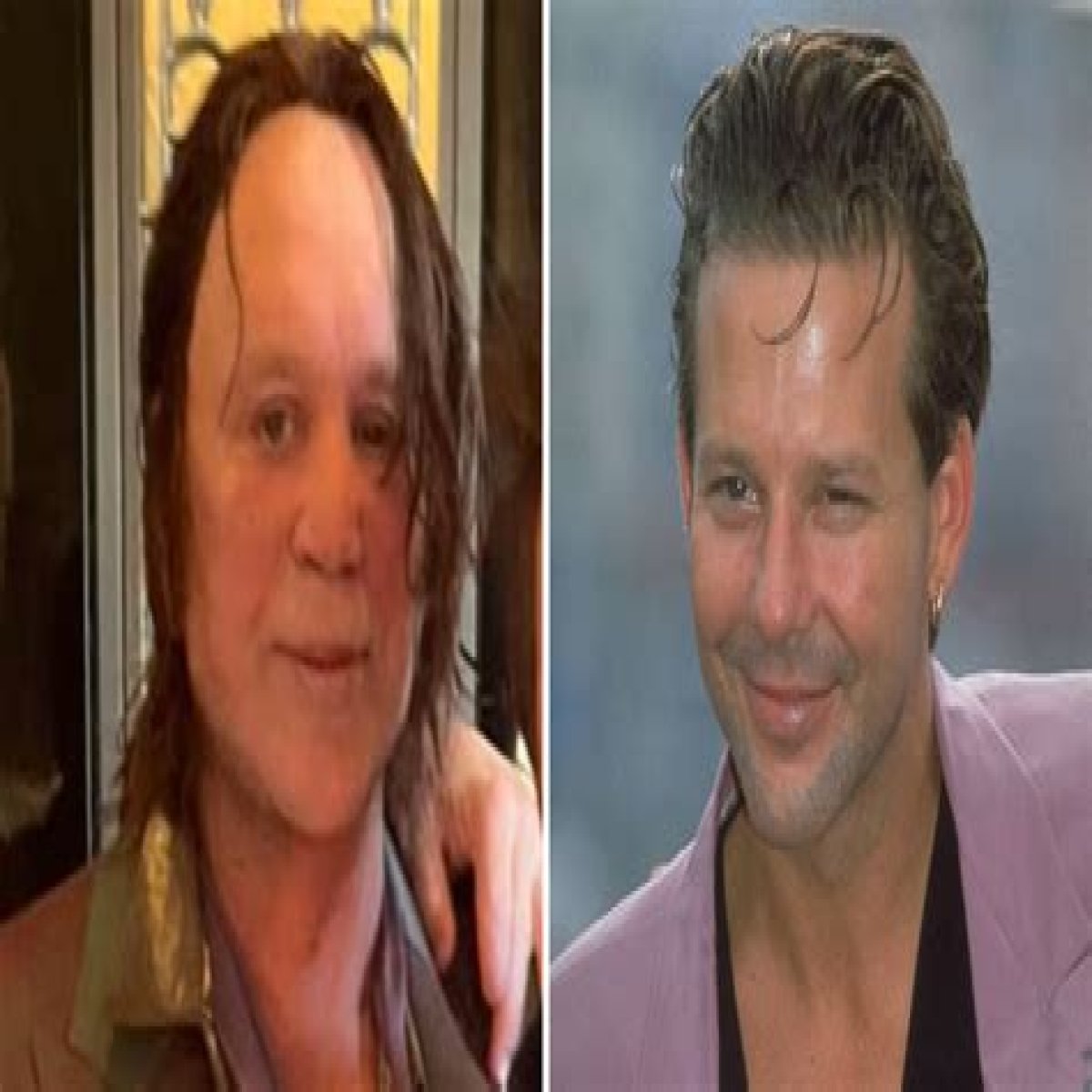 Mickey Rourke Before And After Photos And Plastic Surgery 2023