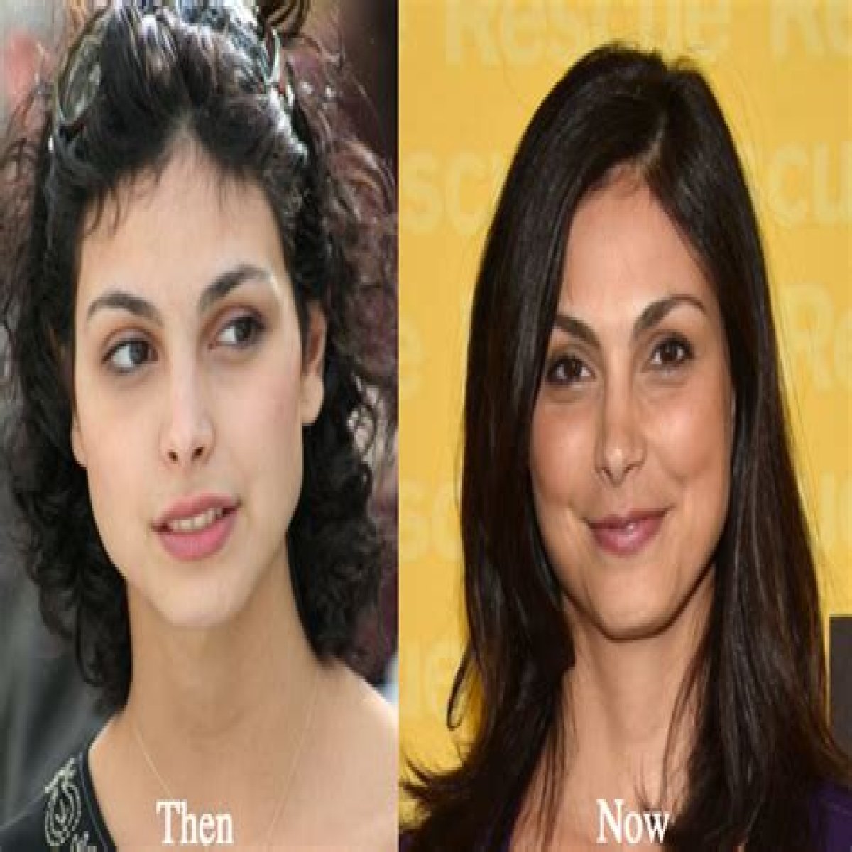Morena Baccarin Plastic Surgery Before and After