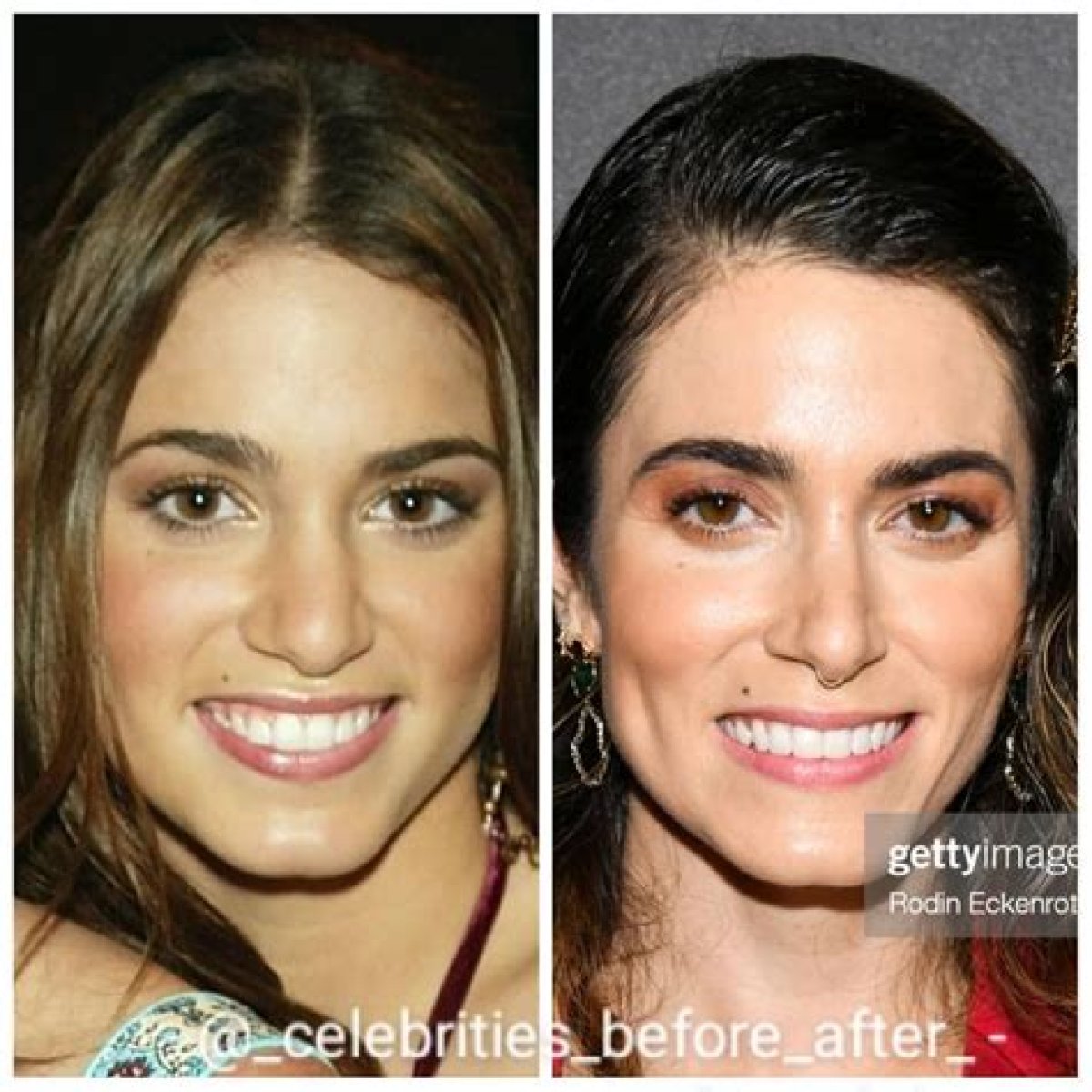 Nikki Reed Plastic Surgery Before and After