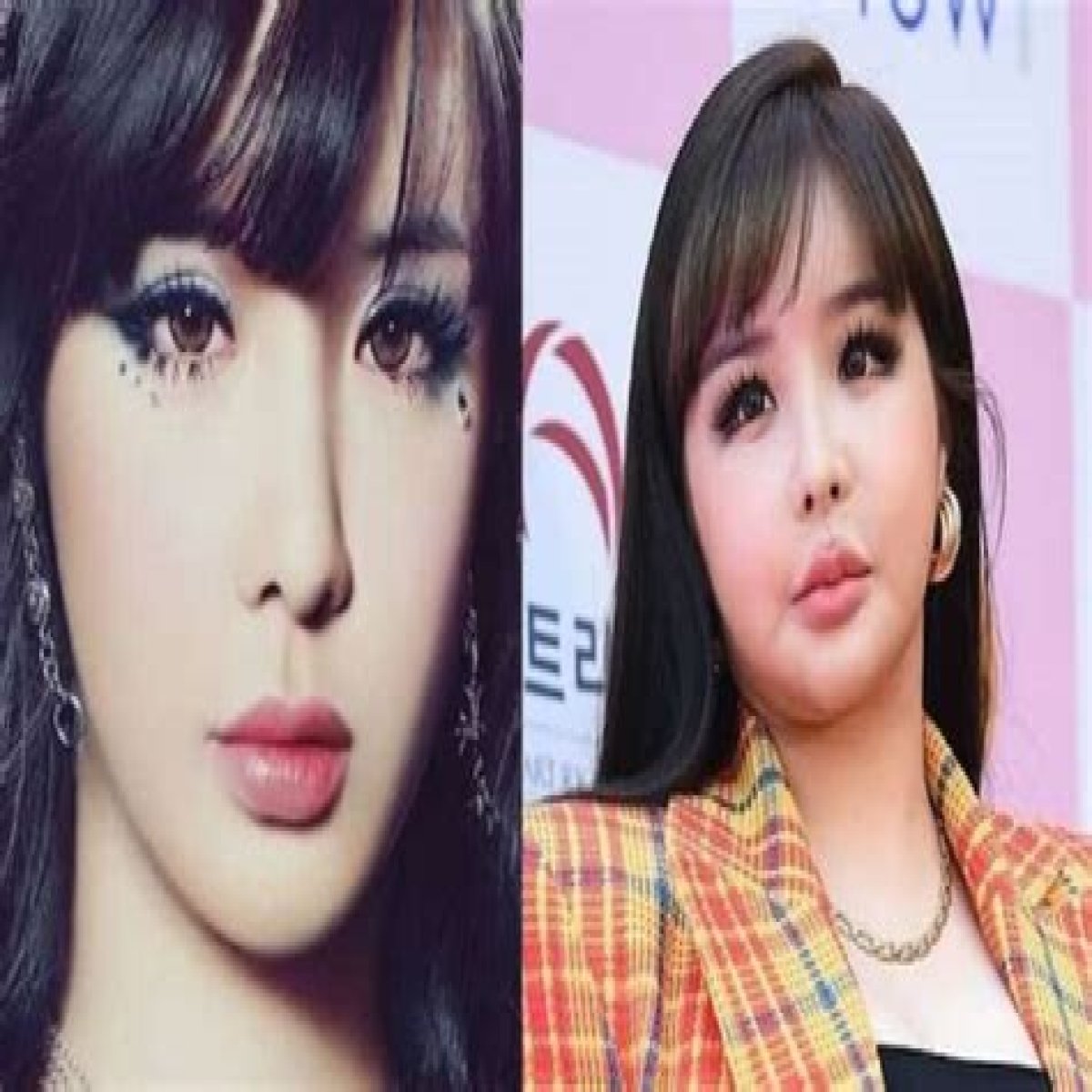 Park Bom Plastic Surgery, Before And After Pics – Age And Boyfriend