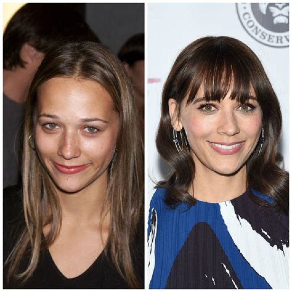 Rashida Jones Plastic Surgery Before and After