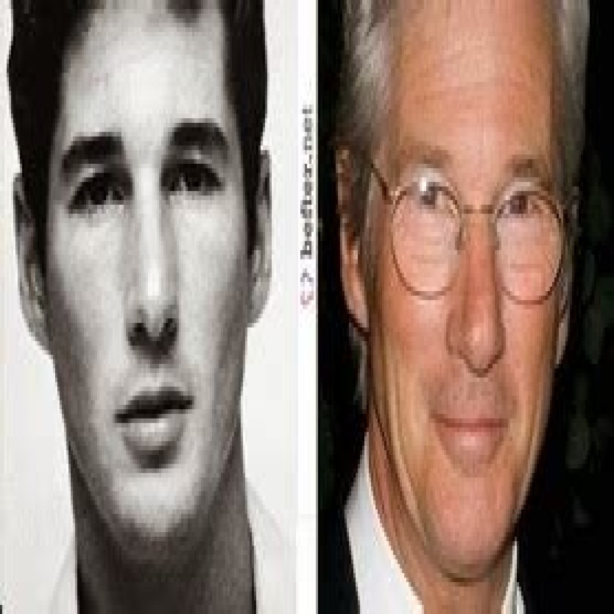 Richard Gere Plastic Surgery Before and After