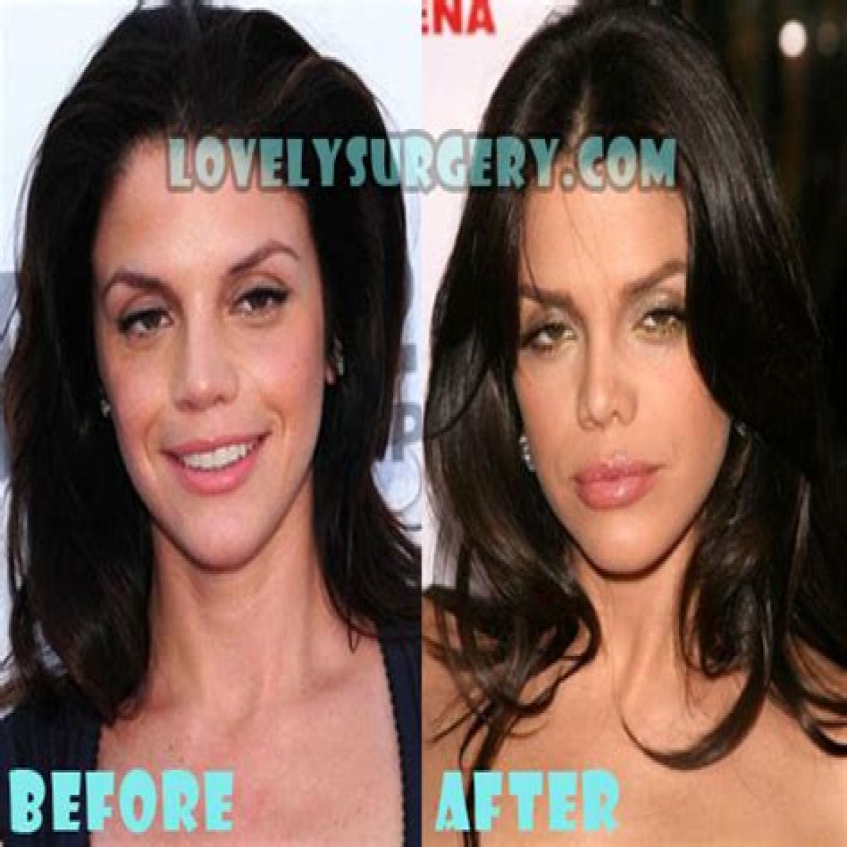 Vanessa Ferlito Plastic Surgery Before and After