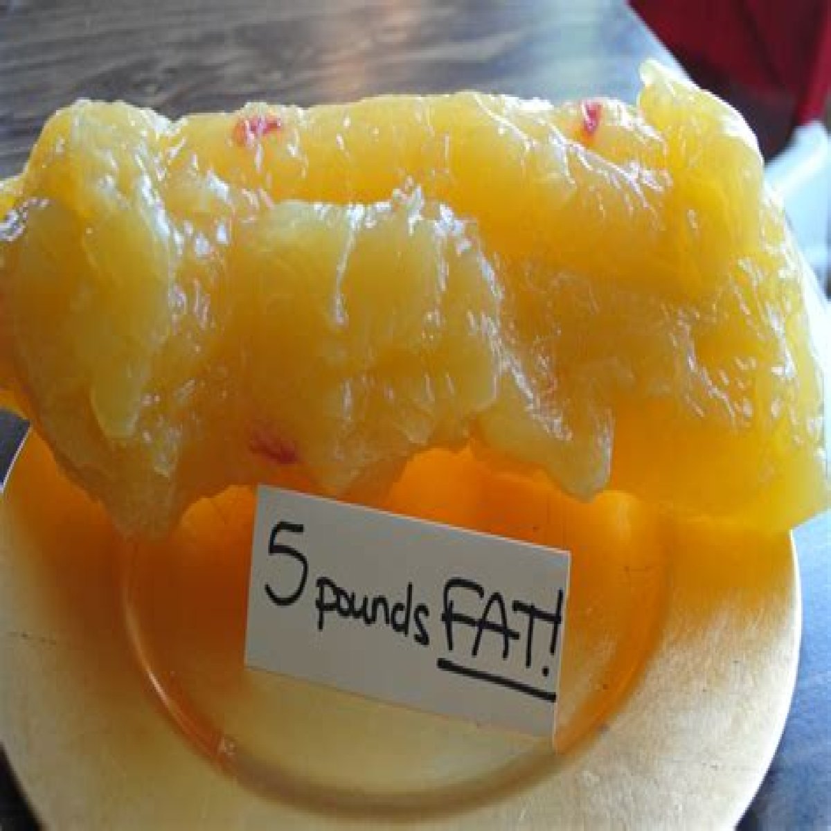 Visualizing 30 Pounds Of Fat: Unveiling The Health Implications