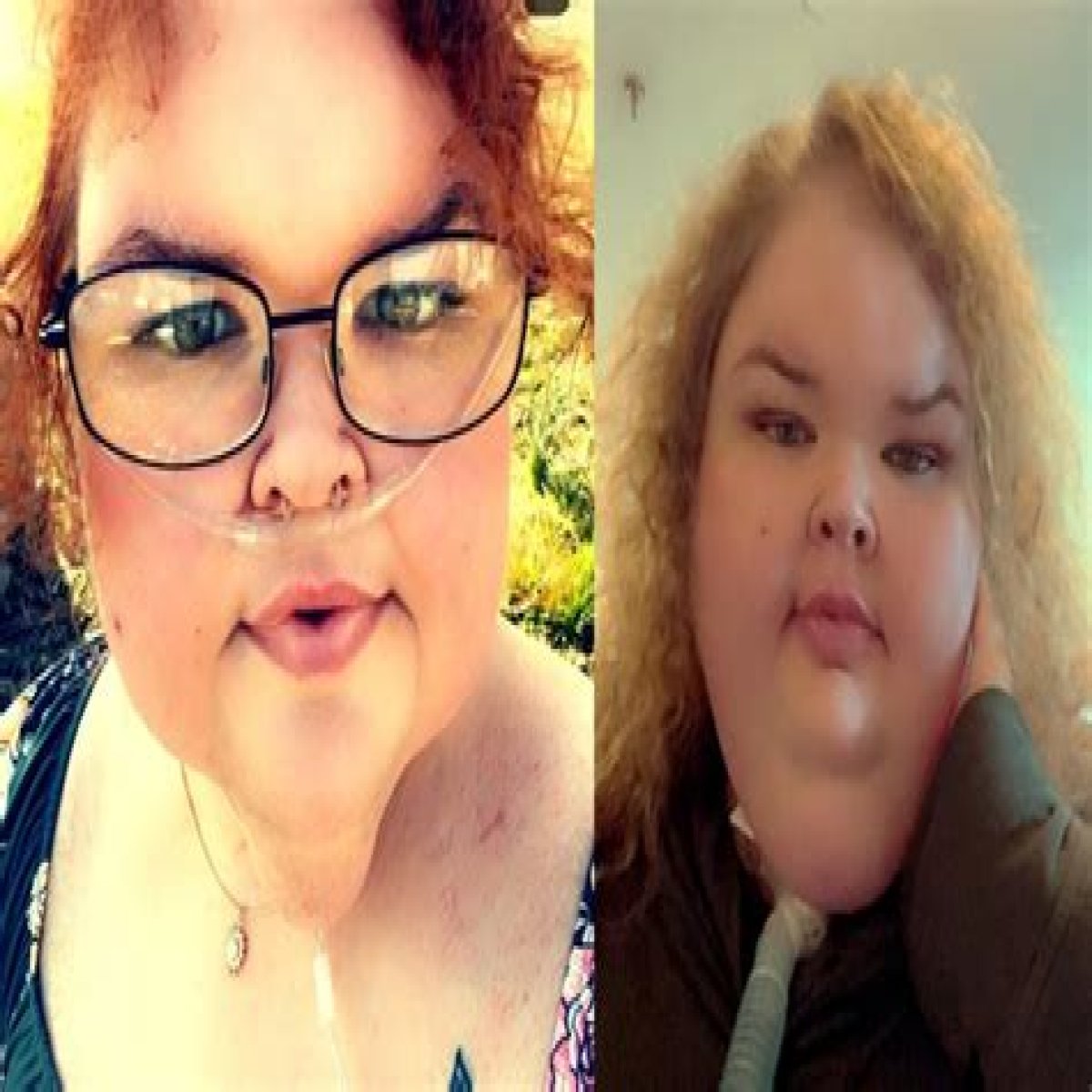 Weight Loss Surgery, Instagram, Now!