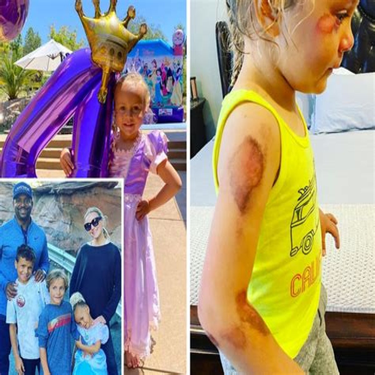 What Happened To Alfonso Ribeiro Daughter After Scooter Accident?
