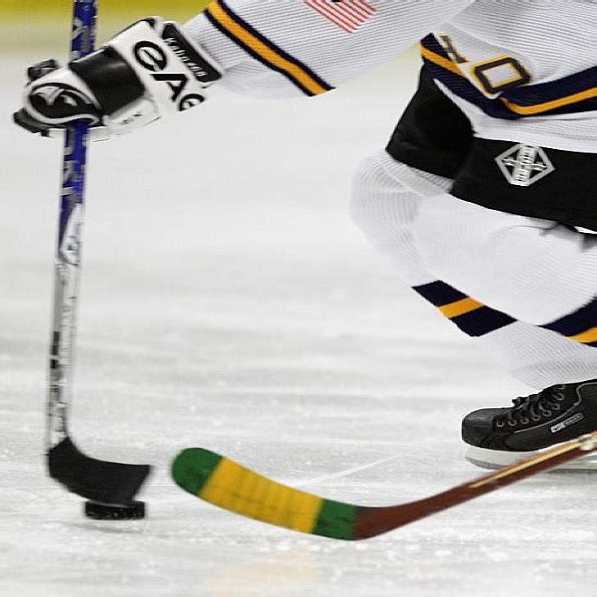 who was Teddy Balkind and what was Hockey Player cause of death?