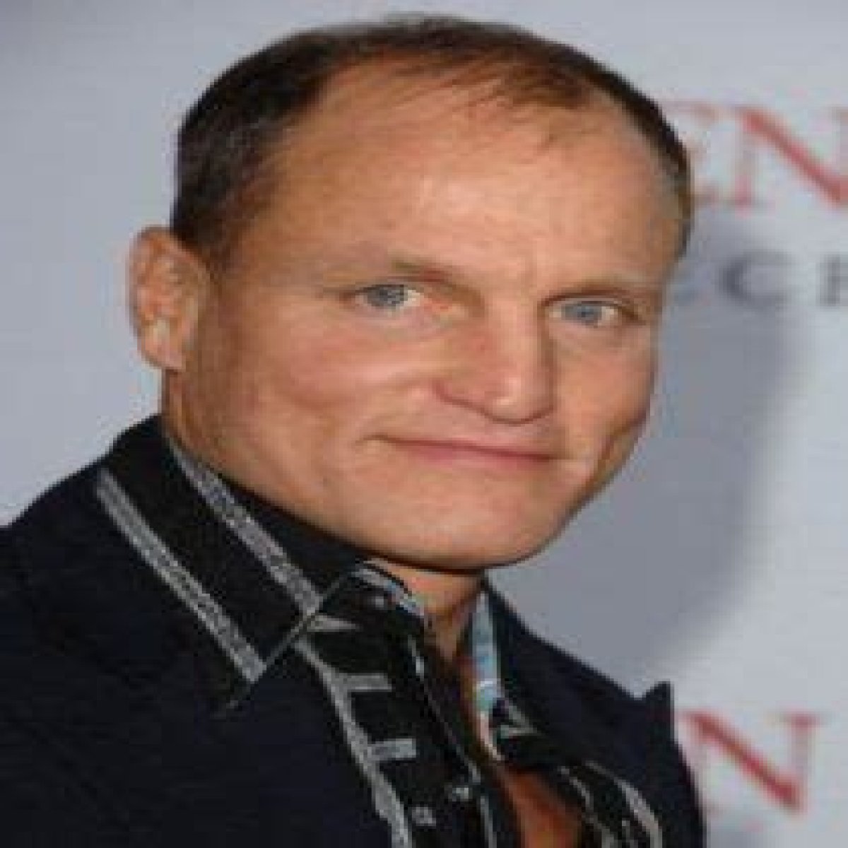 Woody Harrelson Plastic Surgery Before and After